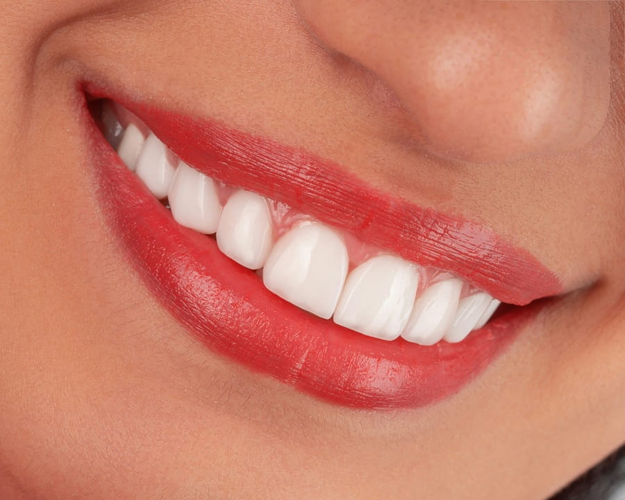Dental laboratory technician in Iran working on ceramic crowns